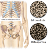 Jak zapobiegać osteoporozie?