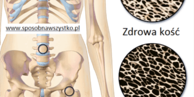Jak zapobiegać osteoporozie?
